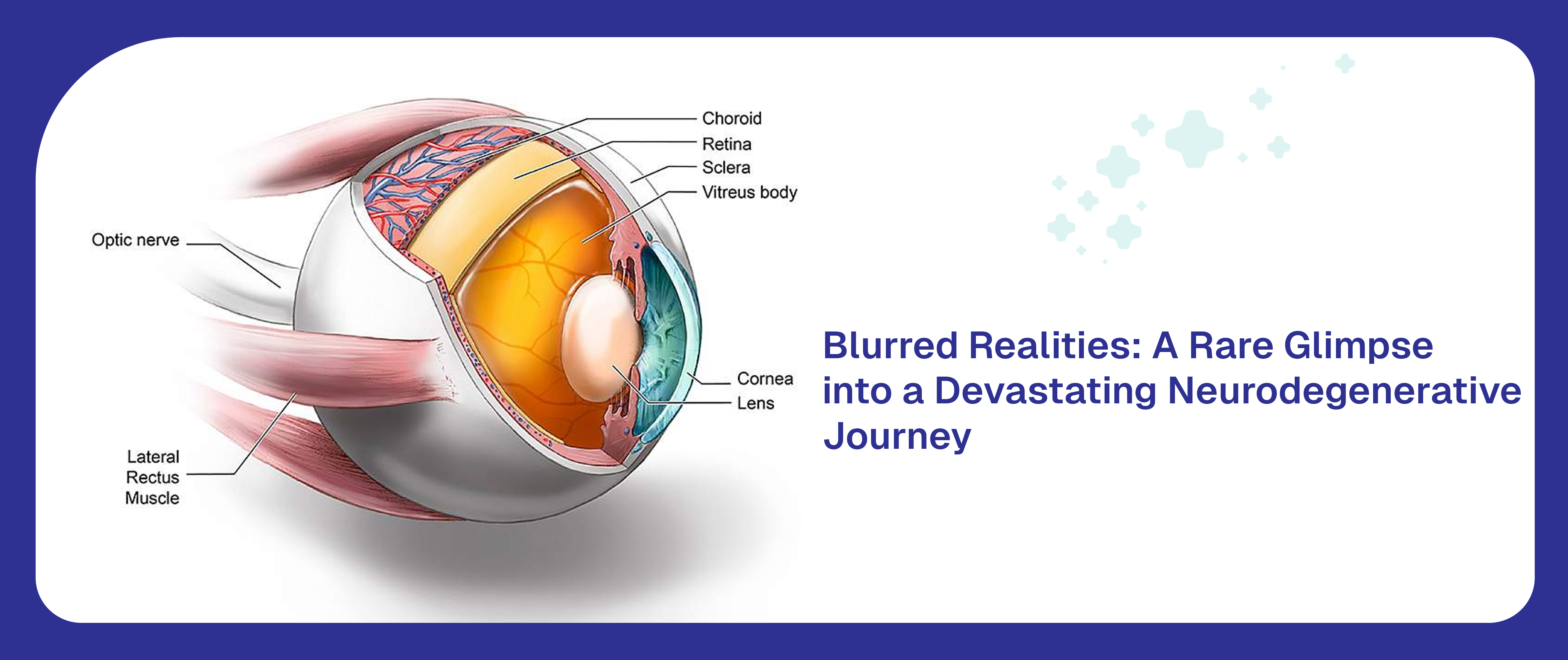 Blurred Realities: Familial CJD Unveils Its Presence Through Predominantly Single Eye Vision Loss—A Rare Glimpse into a Devastating Neurodegenerative Journey